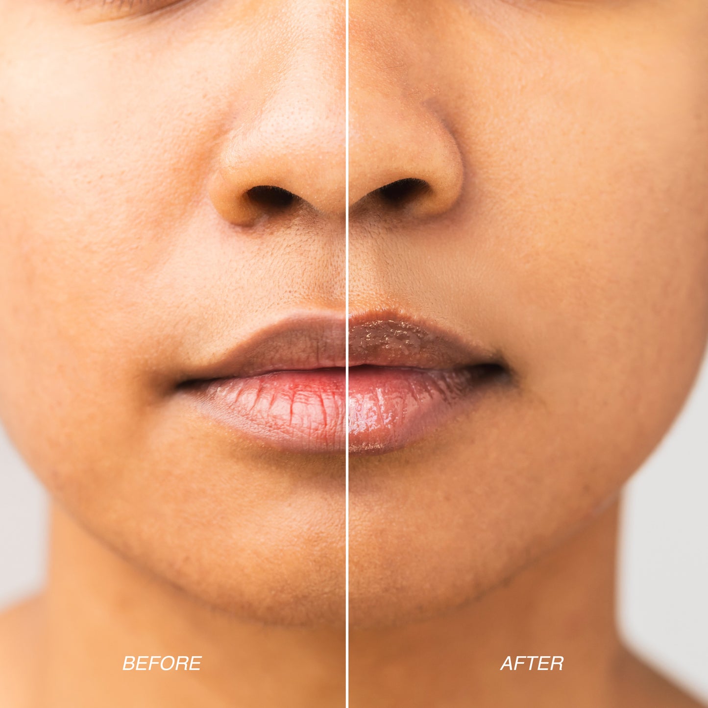 Before and after using lip balm – dry, chapped lips transformed into smooth, moisturized lips.